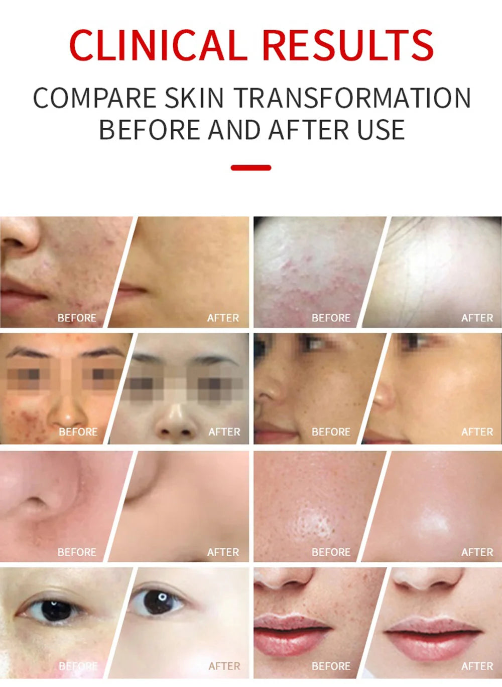 LED Light Therapy Face Mask With Facial Spray
